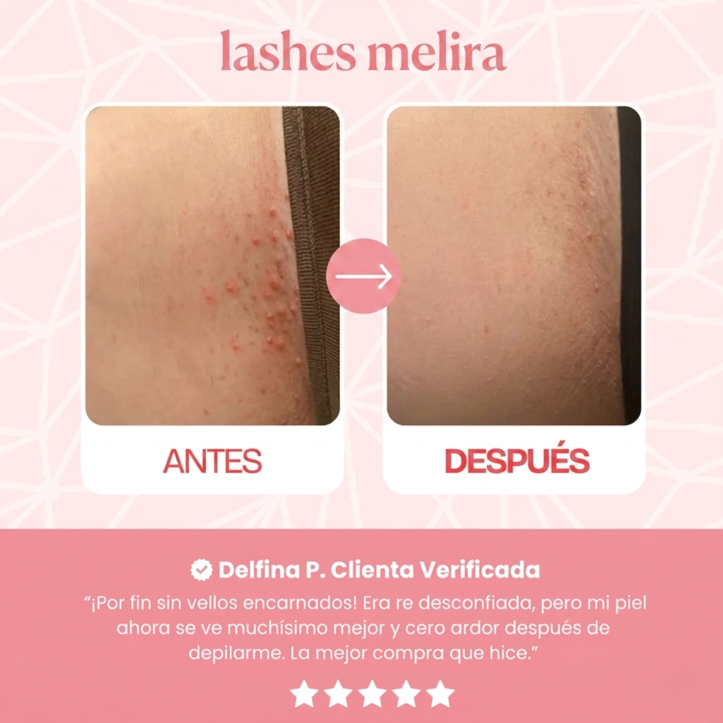 LASHE MELIRA® | DEPILACIÓN SUAVE, SIN DOLOR NI IRRITACIÓN.